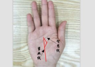 私密三角区处有痣,揭秘其成因与注意事项